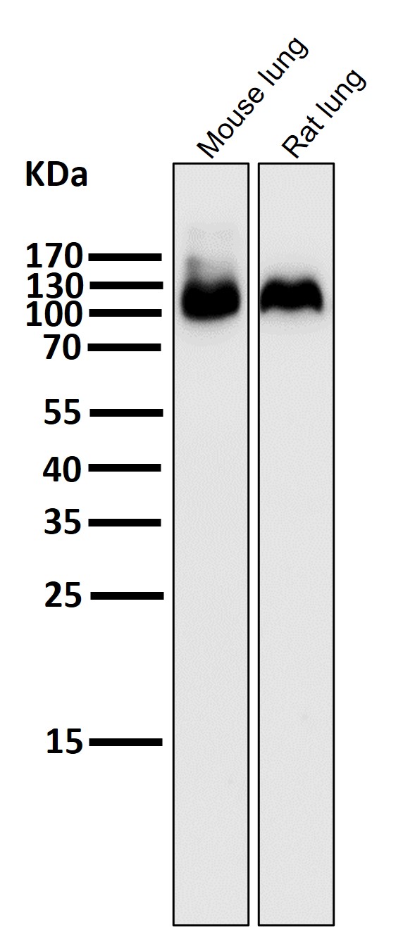 WB - Anti-Integrin beta 3 ITGB3 Rabbit Monoclonal Antibody ABO14204
